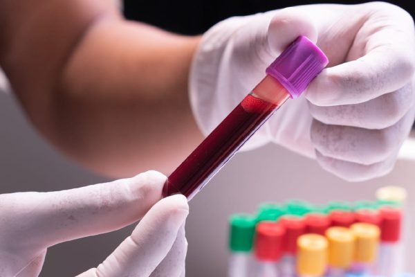 6298fcd3f4f19a1967318c92_why do blood test results vary - imaware
